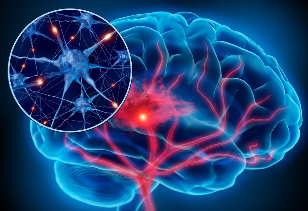 SENSOR CEREBRAL DE ESTRÉS PERMITIRÍA ELABORAR FÁRMACO CONTRA EL ALZHEIMER