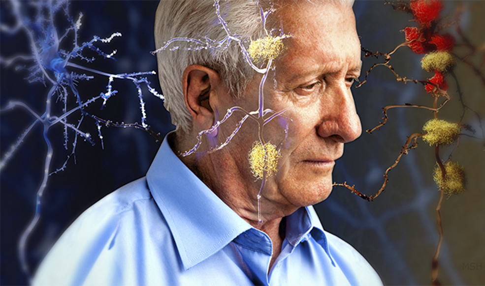 SEMINARIO: UNA MIRADA ACTUALIZADA DEL ALZHEIMER