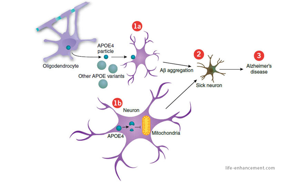 DETECTAN ALTERACIONES CEREBRALES EN PERSONAS SANAS CON RIESGO DE SUFRIR ALZHEIMER